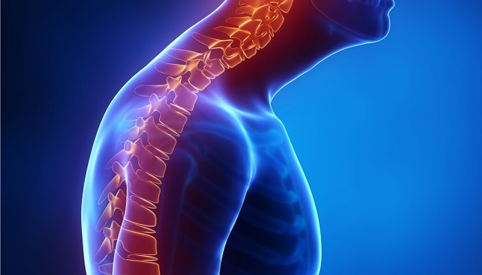 تحقیق پشت گرد round shoulder