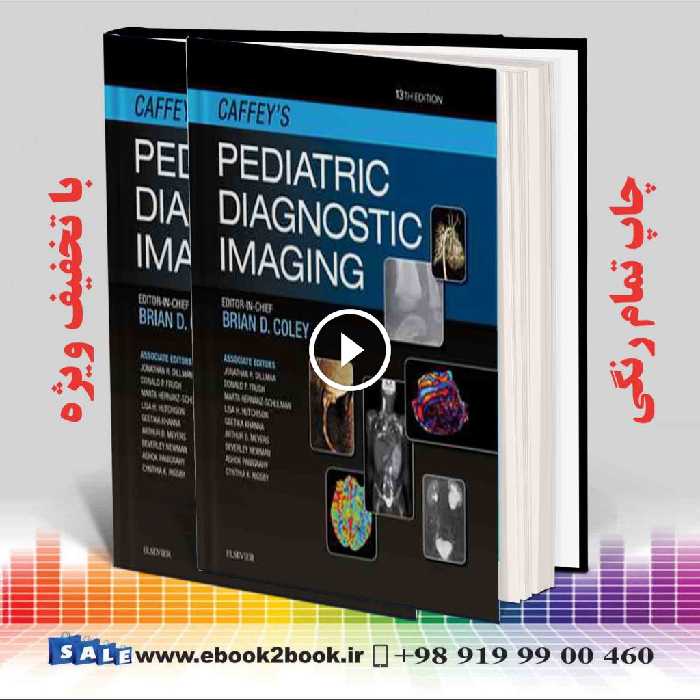 Caffey’s Pediatric Diagnostic Imaging, 2-Volume Set 13th Edition