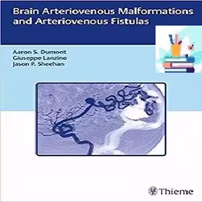 Brain Arteriovenous Malformations and Arteriovenous Fistulas 1ed PDF Video at 1€ - کتاب پزشکی بهار