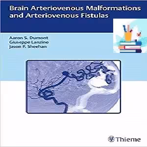 Brain Arteriovenous Malformations and Arteriovenous Fistulas 1ed PDF Video at 1€ - کتاب پزشکی بهار