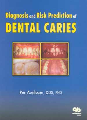 [PDF] دانلود کتاب Diagnosis And Risk Prediction Of Dental Caries, Volume 2, 2000