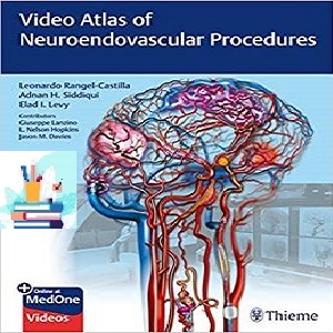 Video Atlas of Neuroendovascular Procedures 1ed PDF Video 2020 at 5€ - کتاب پزشکی بهار