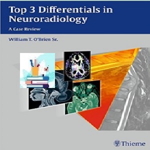 Top 3 Differentials in Neuroradiology TRUE PDF price 1€