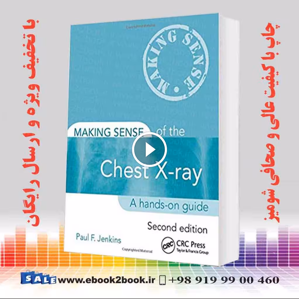 Making Sense of the Chest X-ray: A hands-on guide 2nd Edition