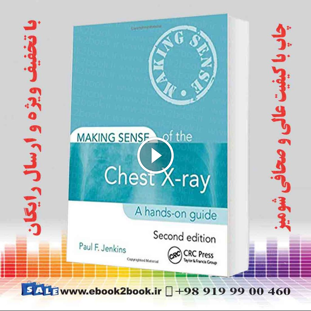 Making Sense of the Chest X-ray: A hands-on guide 2nd Edition