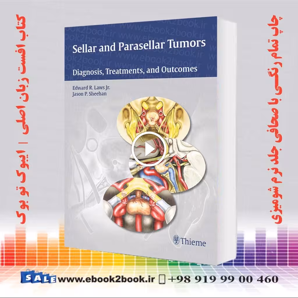 Sellar and Parasellar Tumors