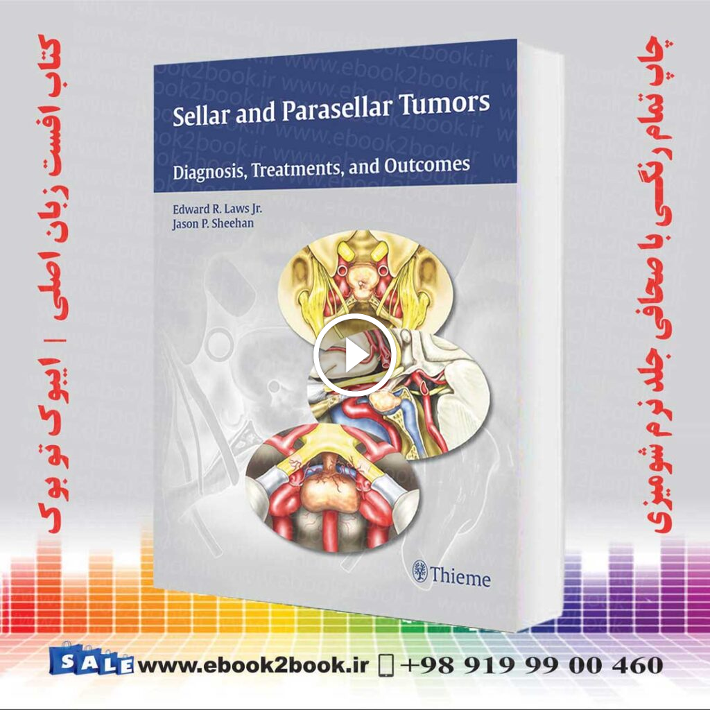 Sellar and Parasellar Tumors