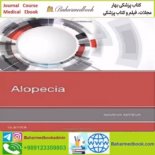 Alopecia TRUE PDF price 1€ - کتاب پزشکی بهار