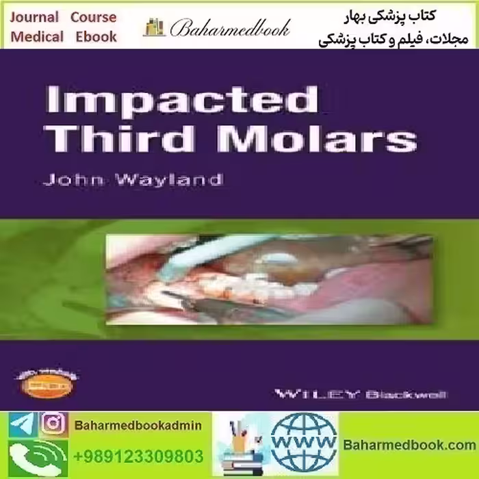 Impacted Third Molars 2018 TRUE PDF price 1€ - کتاب پزشکی بهار