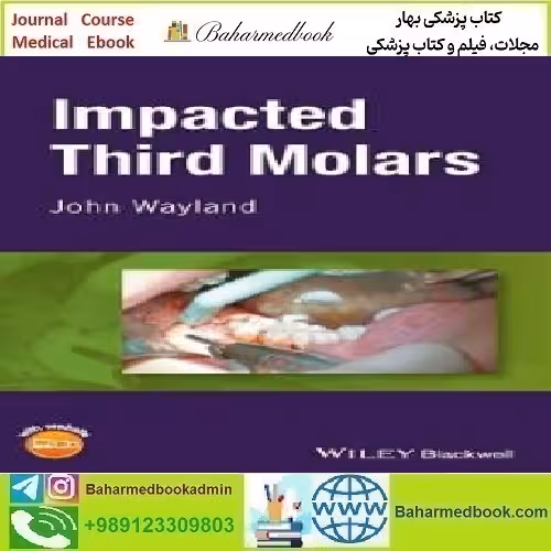 Impacted Third Molars 2018 TRUE PDF price 1€ - کتاب پزشکی بهار