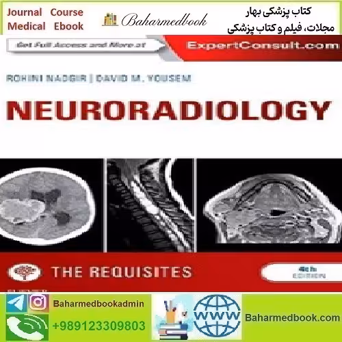 Neuroradiology The Requisites 2017 TRUE PDF price 1€ - کتاب پزشکی بهار
