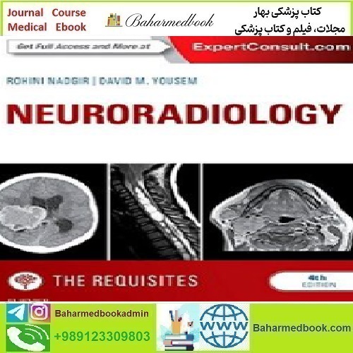 Neuroradiology The Requisites 2017 TRUE PDF price 1€ - کتاب پزشکی بهار
