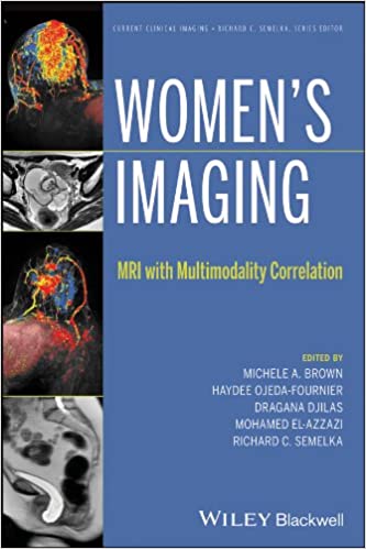 Women’s Imaging: MRI with Multimodality Correlation - کتاب پزشکی بهار