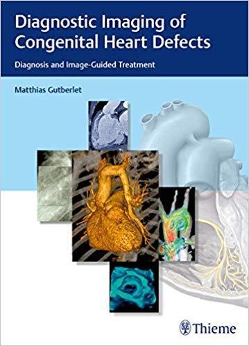 Diagnostic Imaging of Congenital Heart Defects Diagnosis and Image-Guided Treatment 2020 PDF - کتاب پزشکی بهار