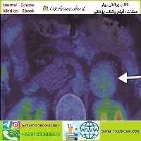 ARRS Breakthroughs in Nuclear Medicine for Neurology and