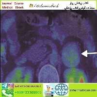 ARRS Breakthroughs in Nuclear Medicine for Neurology and