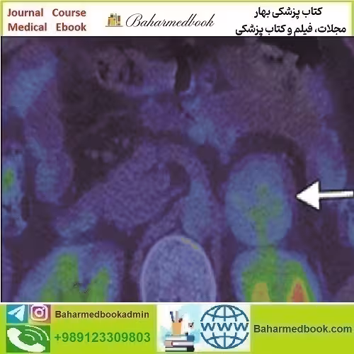 ARRS Breakthroughs in Nuclear Medicine for Neurology and