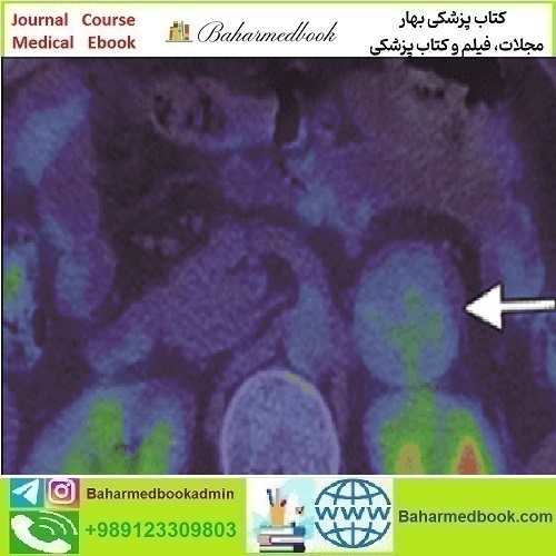ARRS Breakthroughs in Nuclear Medicine for Neurology and