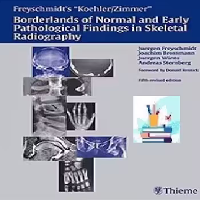 Borderlands of Normal and Early Pathological Fin TRUE PDF pric