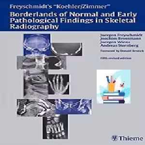 Borderlands of Normal and Early Pathological Fin TRUE PDF pric