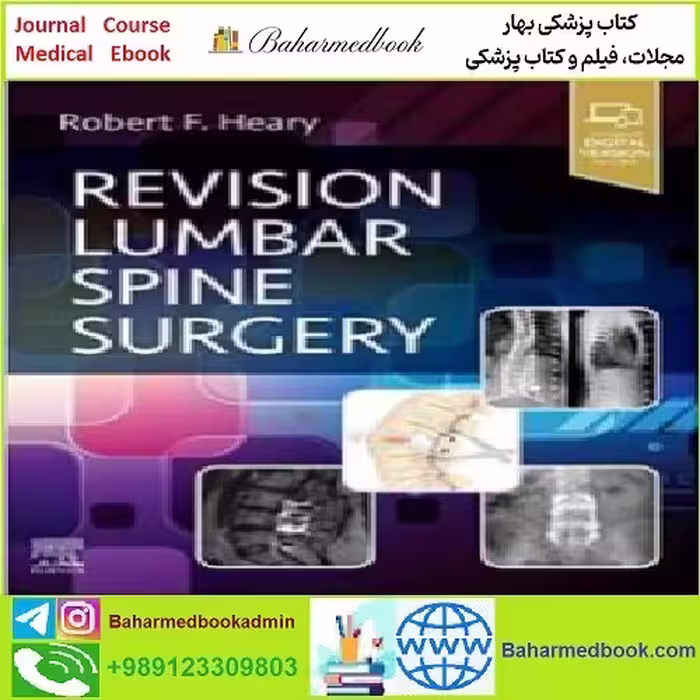 Revision Lumbar Spine Surgery TRUE PDF price 1€ - کتاب پزشکی بهار