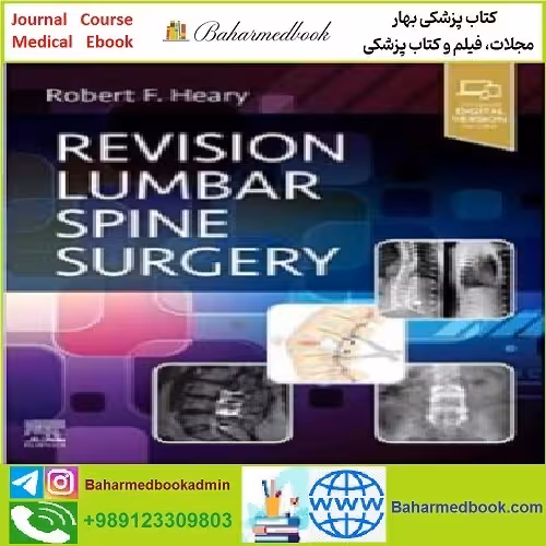 Revision Lumbar Spine Surgery TRUE PDF price 1€ - کتاب پزشکی بهار