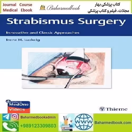 Strabismus Surgery Innovative and Classic Approaches 2021