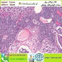 Breast Pathology 2023 video course price 35€ - کتاب پزشکی بهار