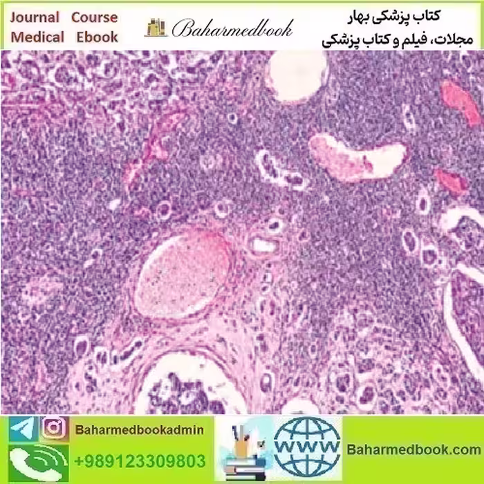 Breast Pathology 2023 video course price 35€ - کتاب پزشکی بهار