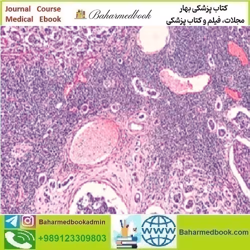 Breast Pathology 2023 video course price 35€ - کتاب پزشکی بهار