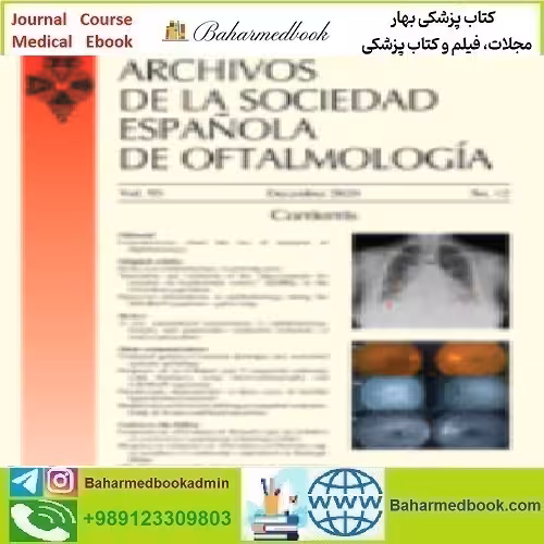 Archivos de la Sociedad Española de Oftalmología English Editio
