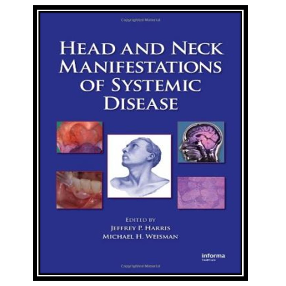 کتاب Head and Neck Manifestations of Systemic Disease اثر P Harris Jeffrey and Michael H Weisman انتشارات مؤلفین طلایی