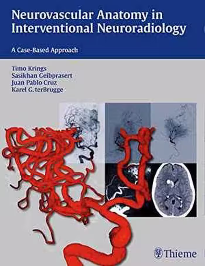 [PDF] دانلود کتاب Neurovascular Anatomy In Interventional Neuroradiology - A Case-Based Approach, 2015