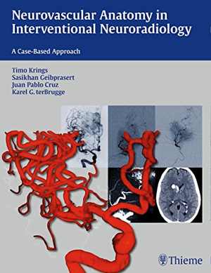 [PDF] دانلود کتاب Neurovascular Anatomy In Interventional Neuroradiology - A Case-Based Approach, 2015
