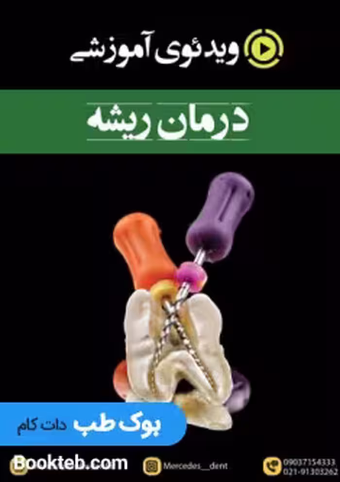 ویدئوی آموزشی درمان ریشه (اندودانتیکس جامع) انگلیسی