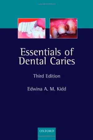 [PDF] دانلود کتاب Essentials Of Dental Caries - The Disease And Its Management, 3rd ed, 2005