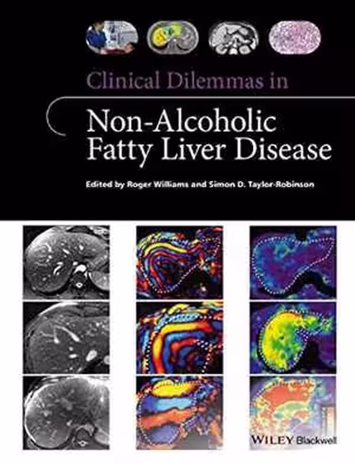 [PDF] دانلود کتاب Clinical Dilemmas In Non-Alcoholic Fatty Liver Disease, 2016