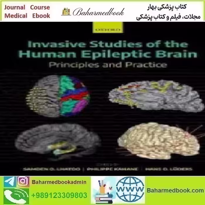 Invasive Studies of the Human Epileptic Brain 2019 TRUE