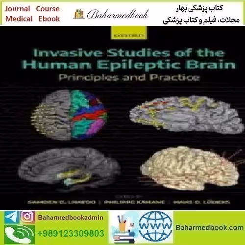 Invasive Studies of the Human Epileptic Brain 2019 TRUE