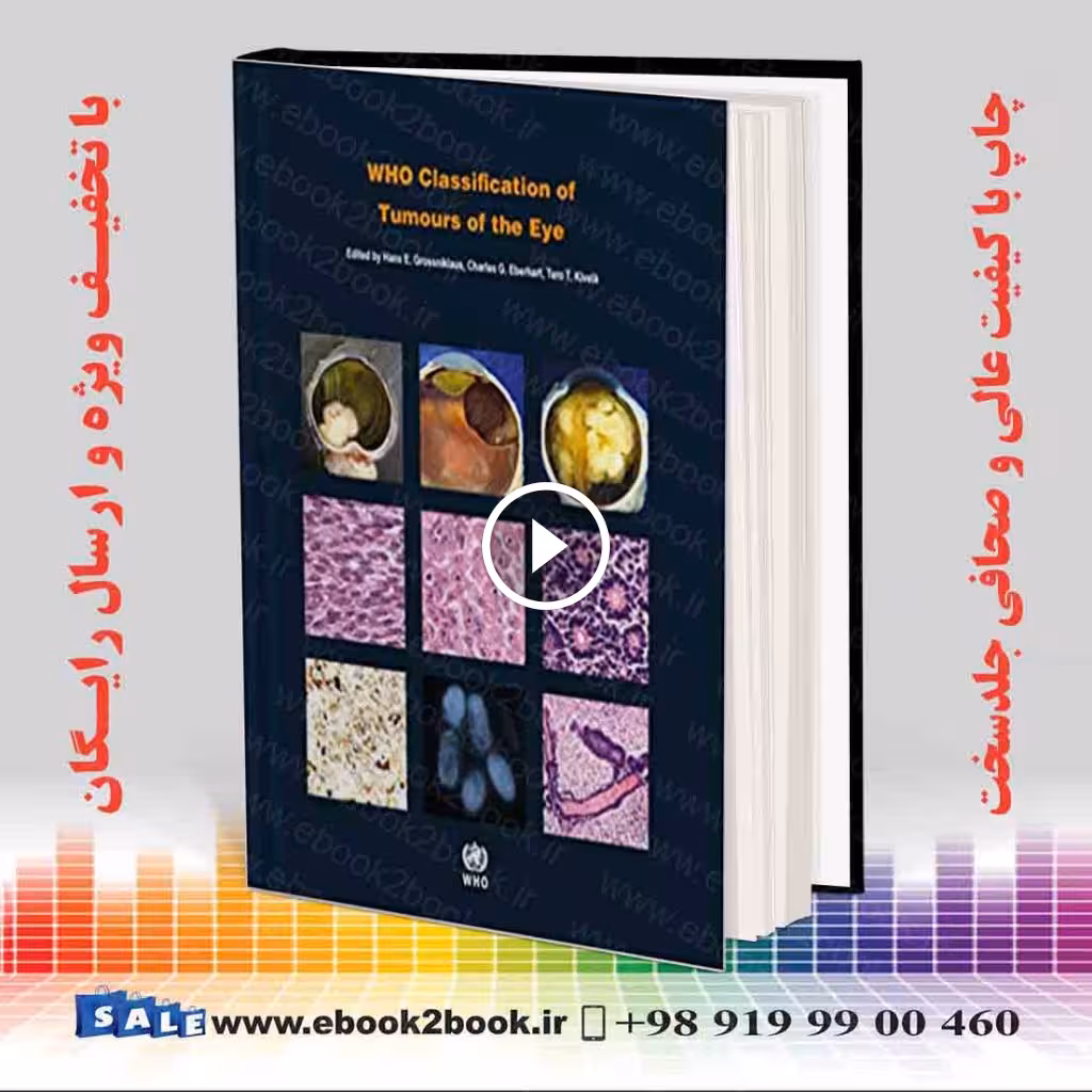 WHO Classification of Tumours of the Eye 4th Edition