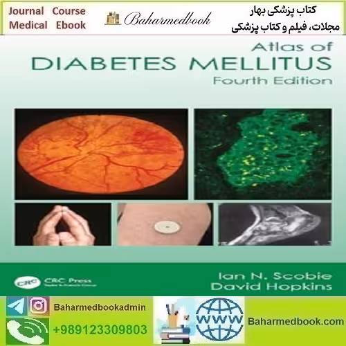 Atlas of Diabetes Mellitus 2024 TRUE PDF دانلود کتاب الکترونیکی