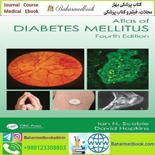 Atlas of Diabetes Mellitus 2024 TRUE PDF دانلود کتاب الکترونیکی