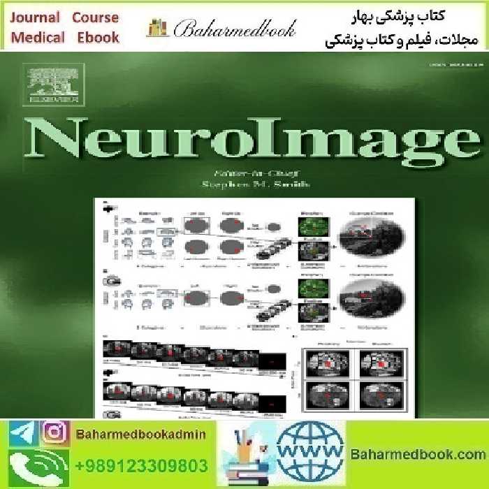 NeuroImage Volume 285 to 292 2024 TRUE PDF price 8€ - کتاب پزشکی بهار