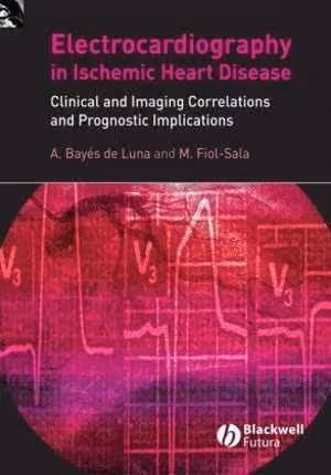 [PDF] دانلود کتاب The Surface Electrocardiography In Ischemic Heart Disease - Clinical And Imaging Correlations And Prognostic Implications, 2008