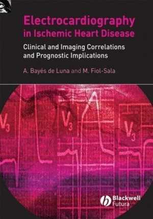 [PDF] دانلود کتاب The Surface Electrocardiography In Ischemic Heart Disease - Clinical And Imaging Correlations And Prognostic Implications, 2008