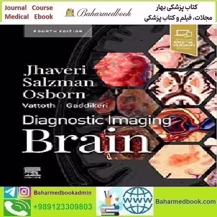 Diagnostic Imaging Brain 2021 TRUE PDF price 1€ - کتاب پزشکی بهار