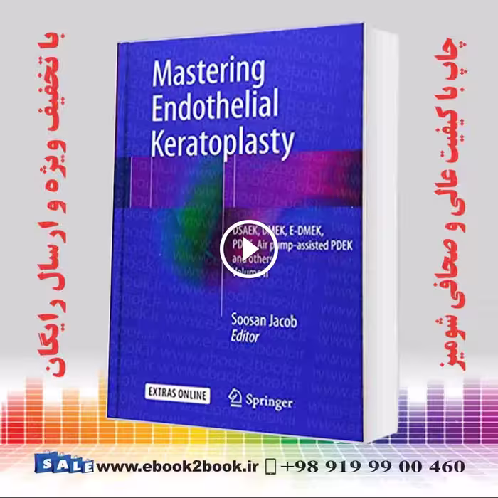 Mastering Endothelial Keratoplasty Volume II
