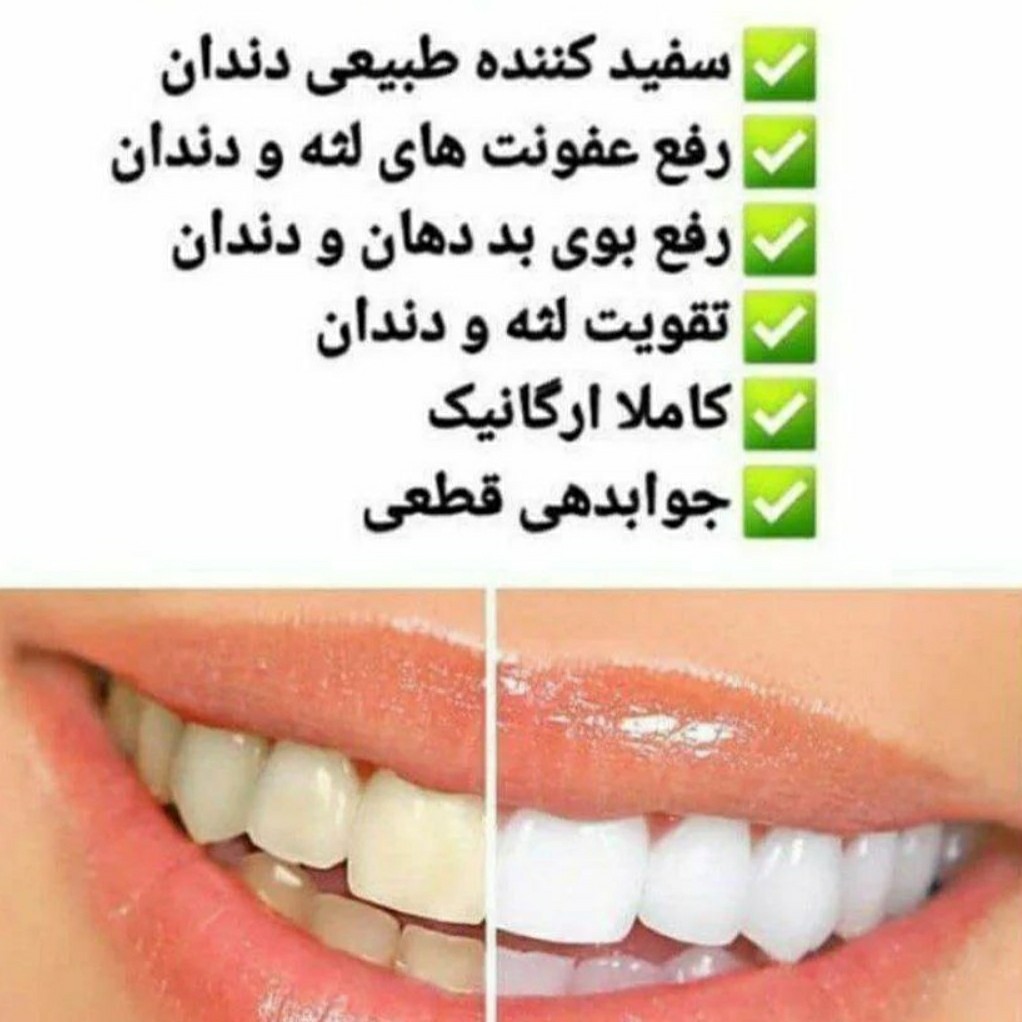 سفیدکننده دندان از برند معجزه کاملا گیاهی سفیدکننده دندان و لثه