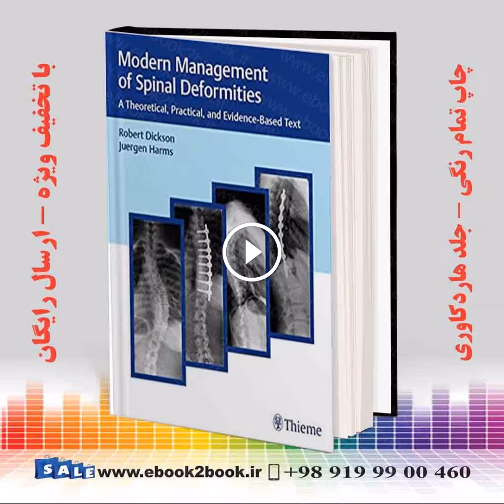 Modern Management of Spinal Deformities