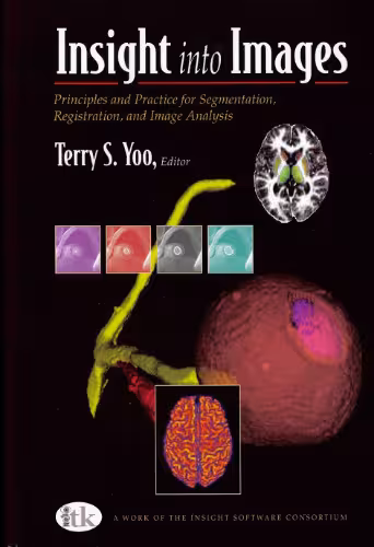 خرید و دانلود نسخه کامل کتاب Insight into images: principles and practice for segmentation, registration, and image analysis